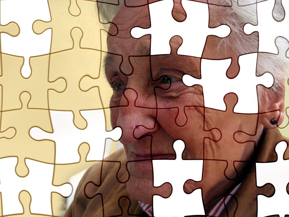 genetikai attores az alzheimer kor kutatasaban 1 genetikai attores az alzheimer kor kutatasaban 1