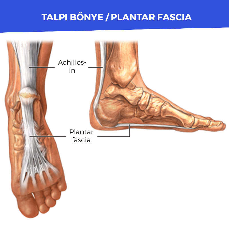 sarokfajdalom okai es kezelese 2