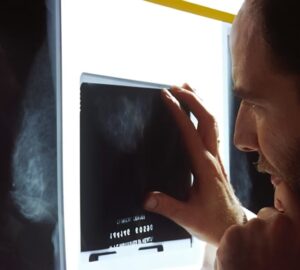 talaltunk egy elvaltozast 1